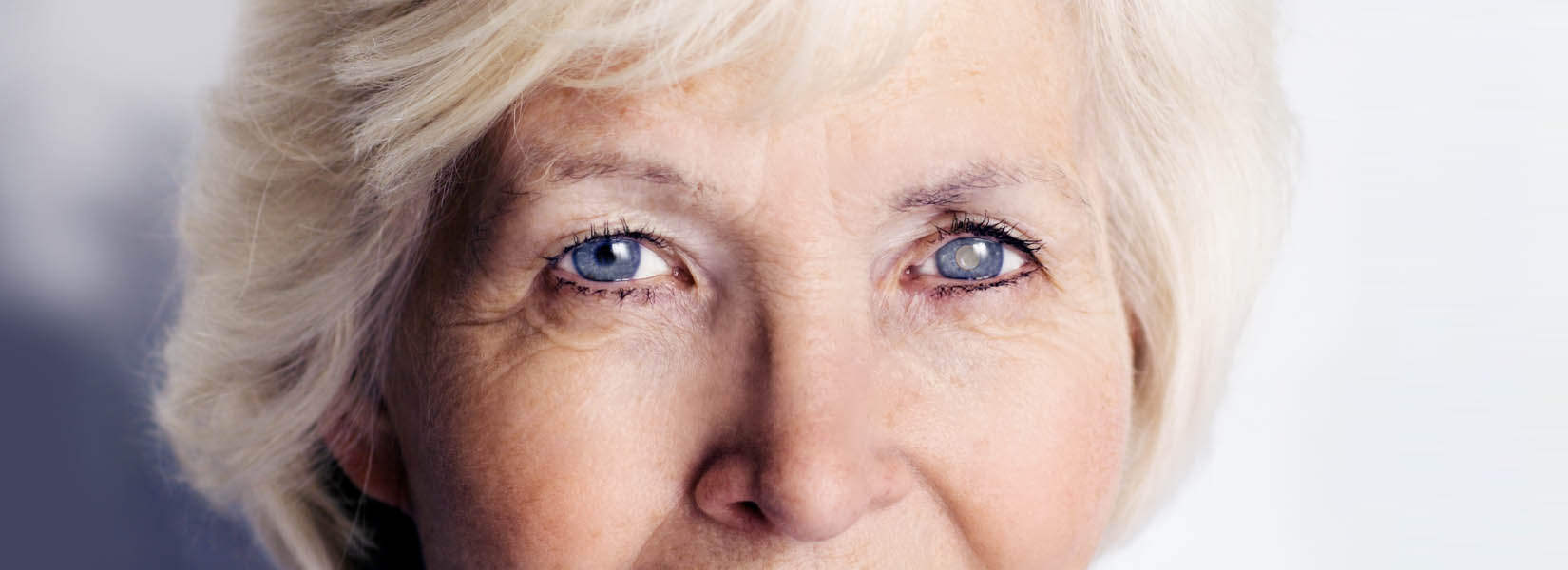 Cataract Surgery in Creve Coeur Township